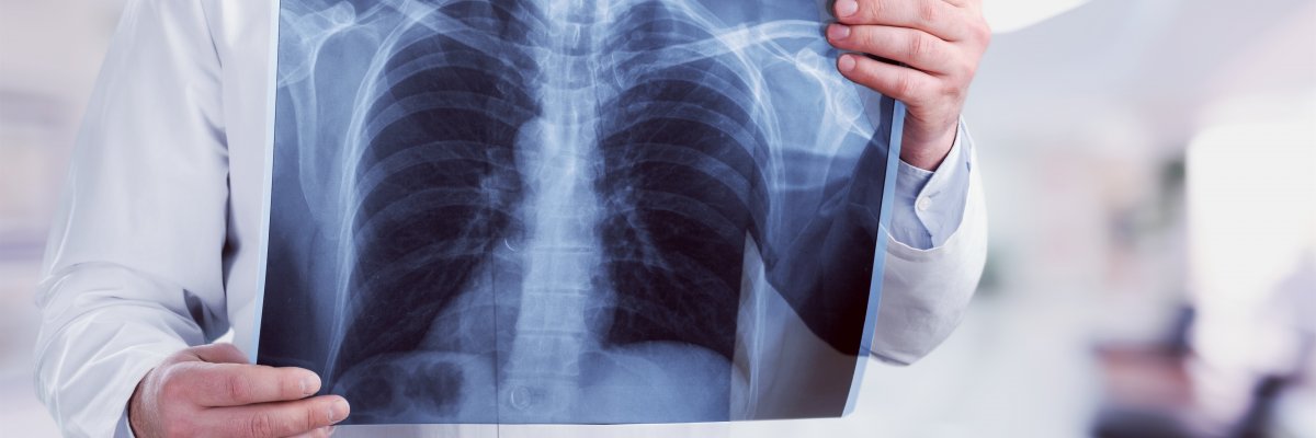 Bécsi orvosok végezték az első tüdőátültetést koronavírusos betegnél Európában