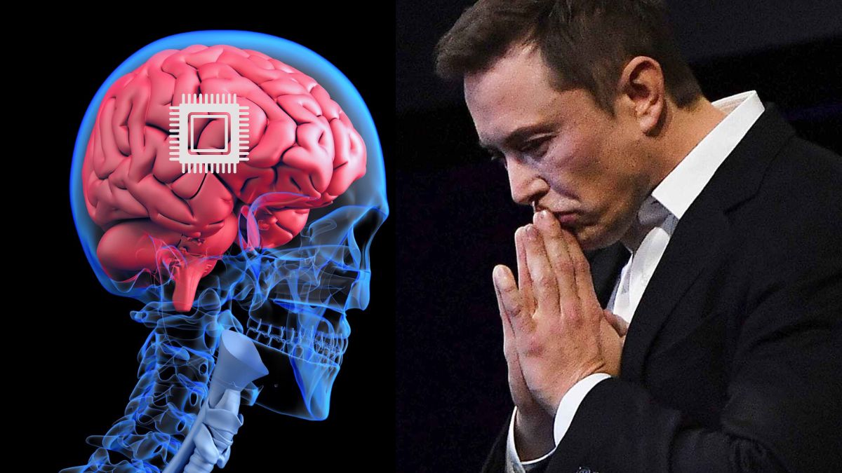 Jöhetnek a filmekből ismert kiborgok: Elon Musk megkapta az engedélyt az emberkísérletekre 