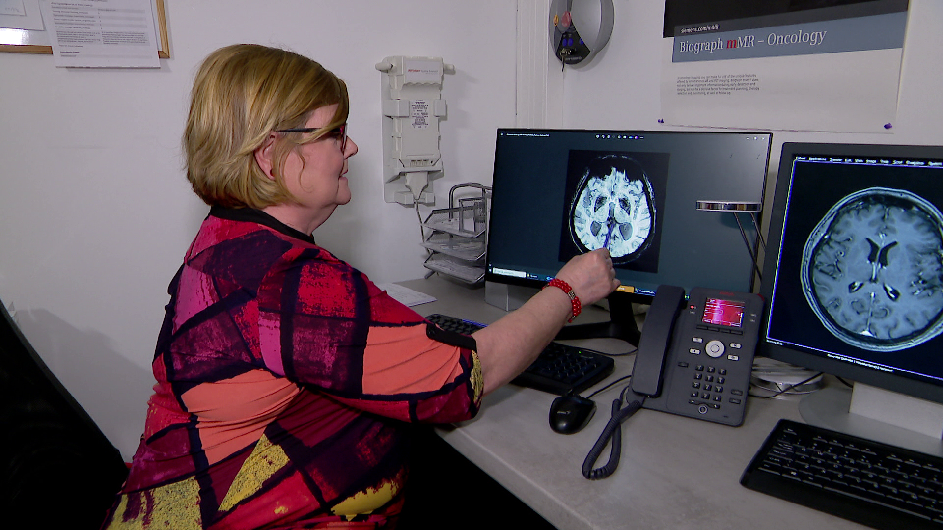 Radar – Hatalmas áttörés az Alzheimer diagnosztikában + videó