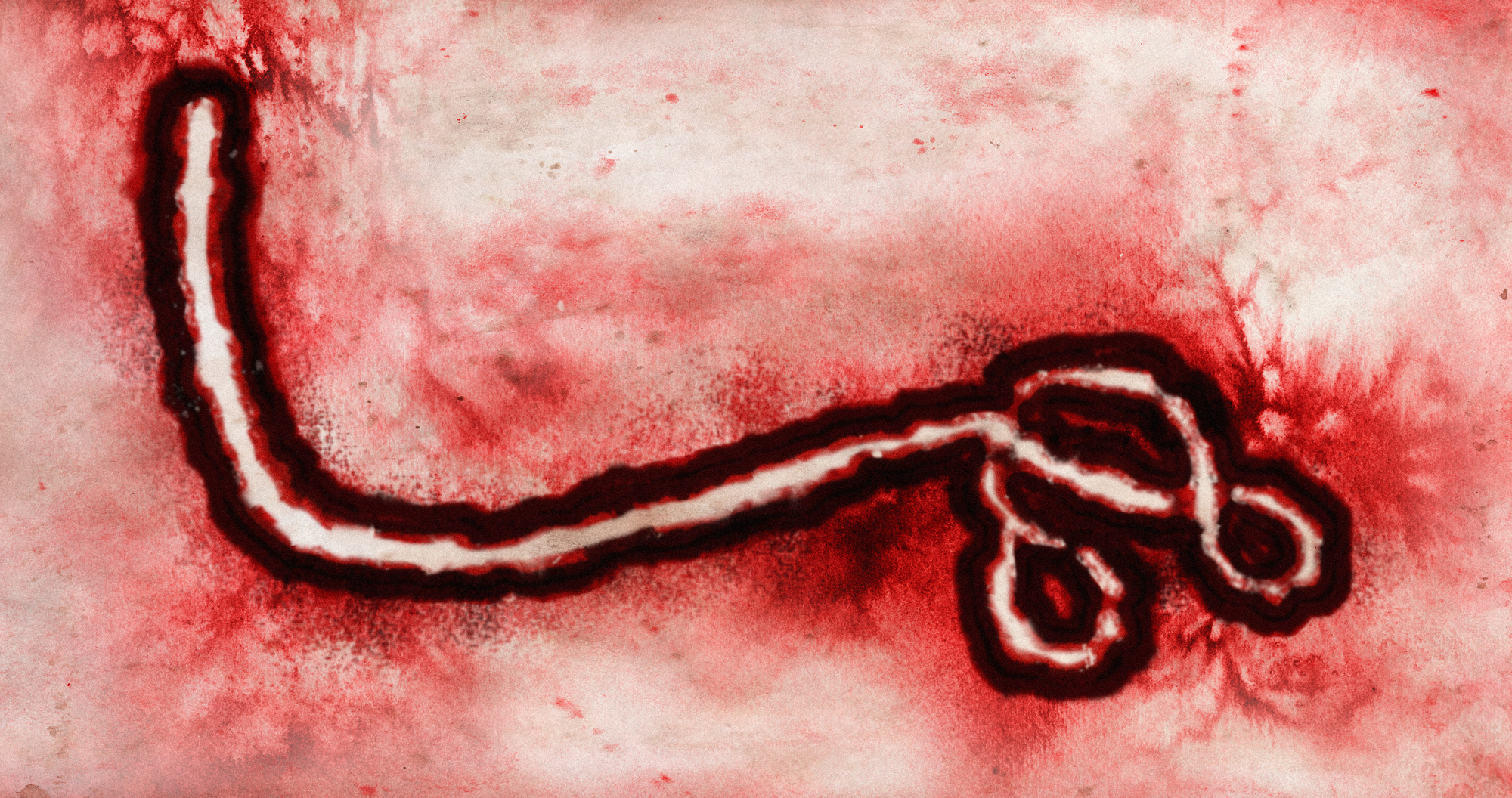 WHO: A klinikákban kezelt páciensek kétharmada túléli az ebolát