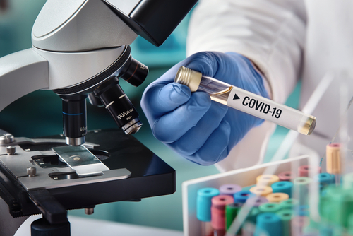 Tesztelési fázishoz ért a koronavírus elleni oltóanyag-fejlesztés
