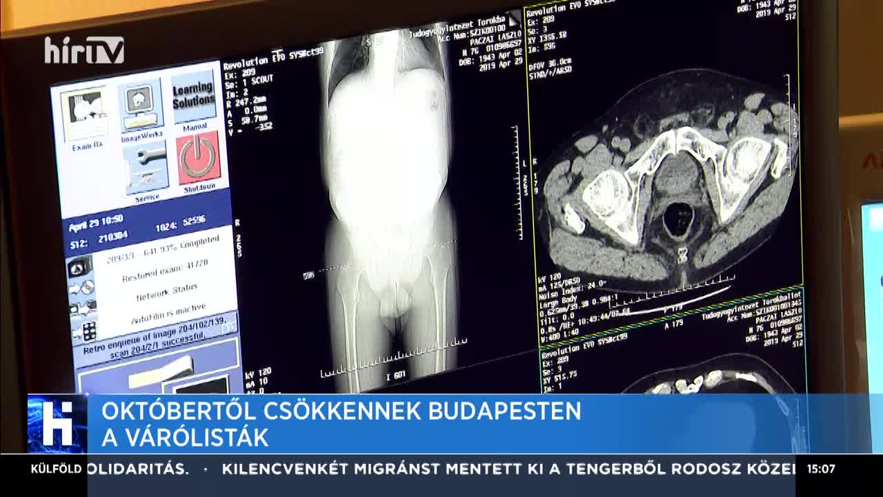 Októbertől csökkennek Budapesten a várólisták