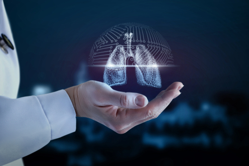 A tüdődaganatok 70 százaléka korai stádiumban kimutatható CT-vel egy brit kutatás szerint