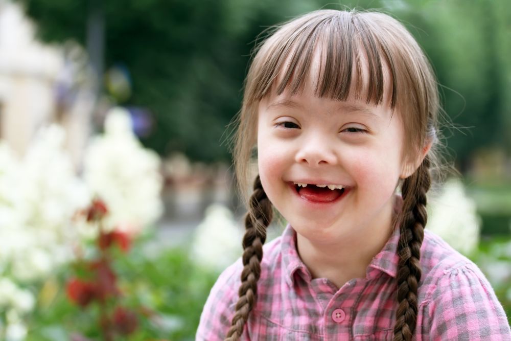 Down-szindrómás gyermekeket támogat a Mészáros Csoport