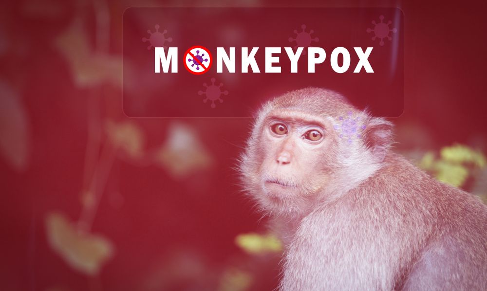 Eddig tizenegy országban észleltek majomhimlős megbetegedéseket