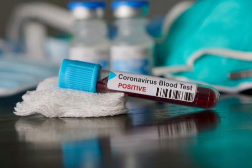  Koronavírus - A fertőzöttek száma 651 millió, a halálos áldozatoké 6,658 millió 