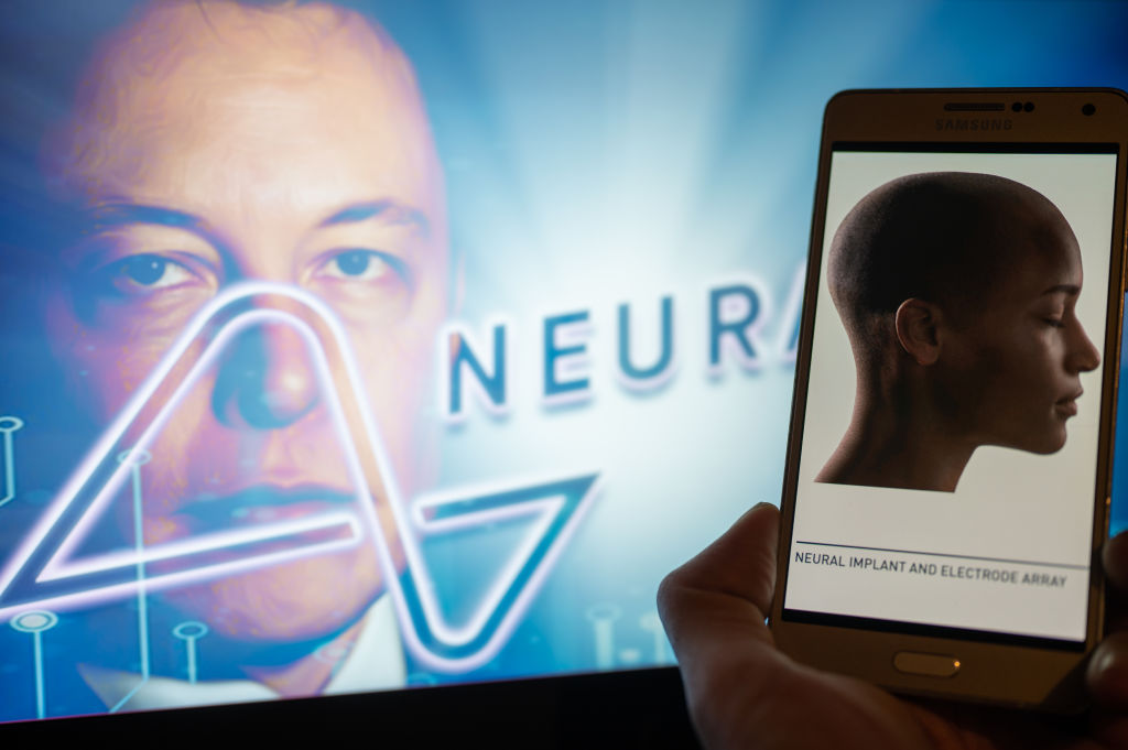 Globál: Elon Musk megcsinálja: emberkísérletet agyba épített chip-pel 