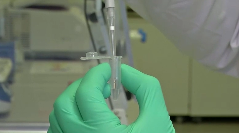 Hónapok óta nem csökken a Hepatitis A fertőzések száma Drégelypalánkon